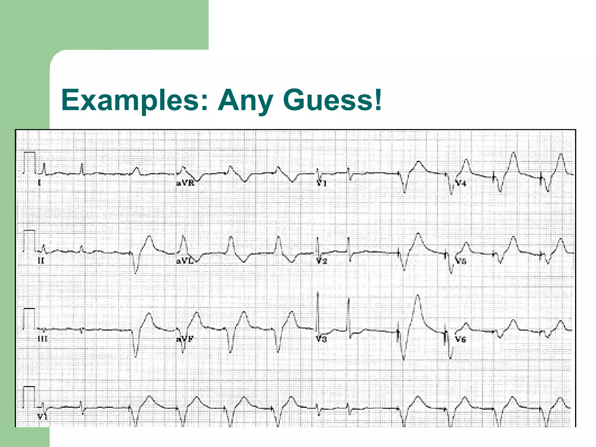 Examples: Any Guess! 