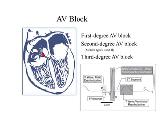 Artificial Cardiac Pacemaker | PPTX