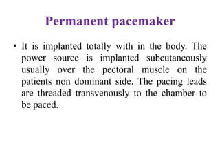 Pacemaker | PPSX