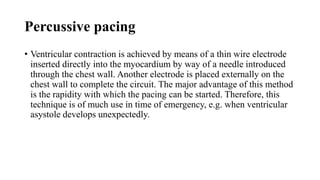 Pacemaker | PPTX