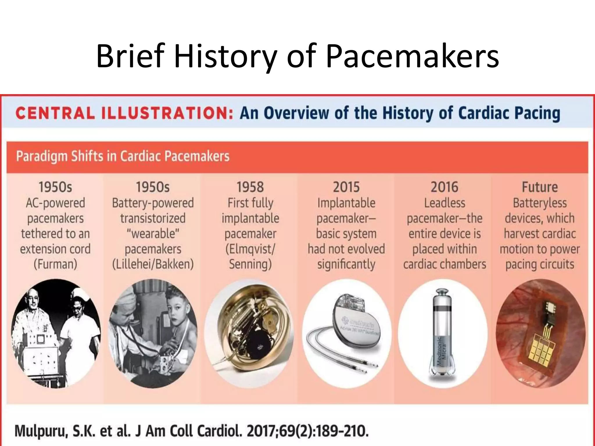 Pacemaker | PPTX