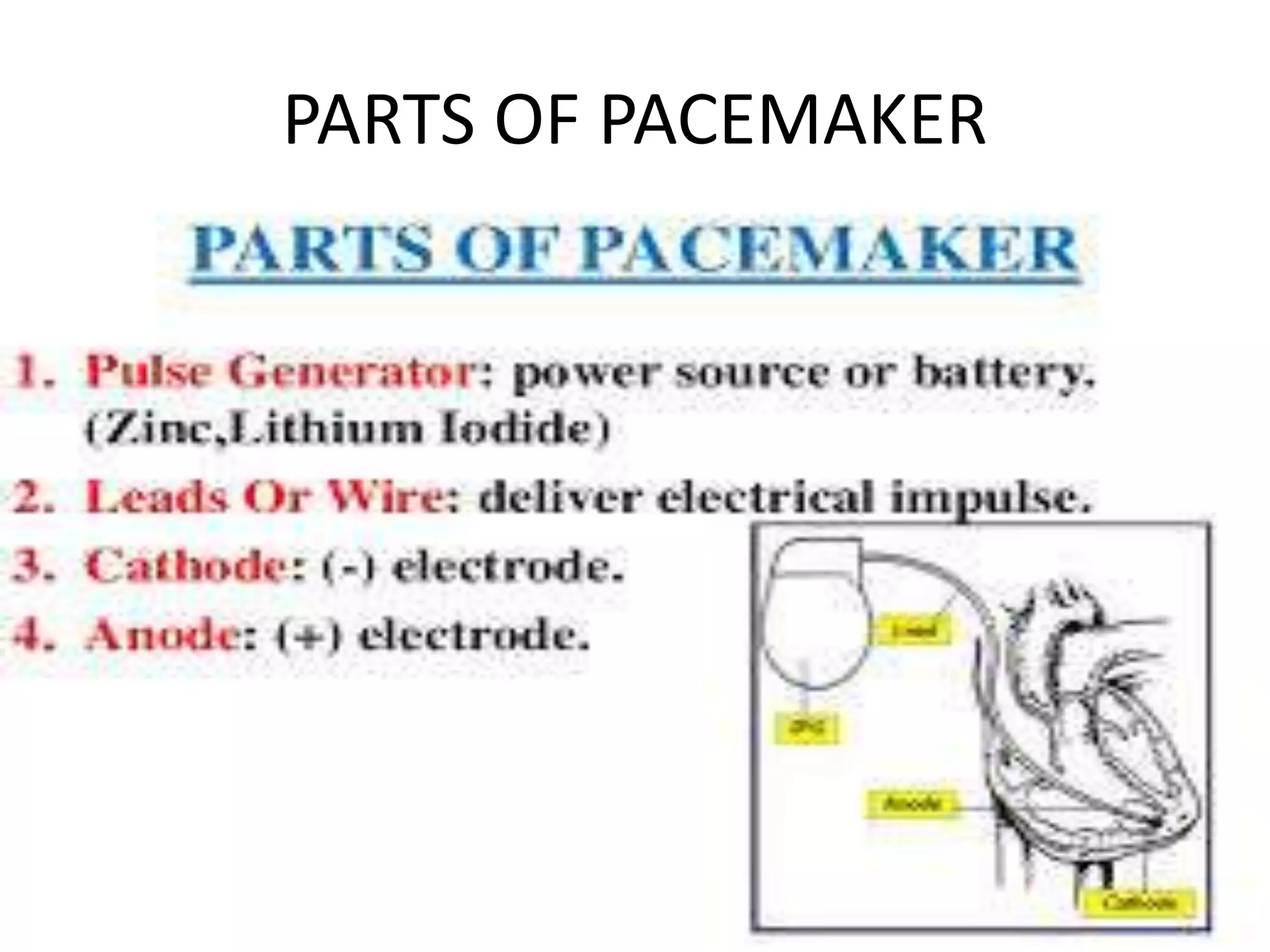 Pacemaker | PPTX