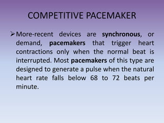 Pacemaker | PPT