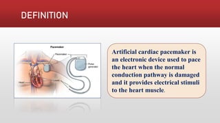 Pacing Definition Pacemaker PACEMAKER | PDF