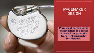 Zipper Pacemaker Closure Device PACEMAKER | PDF