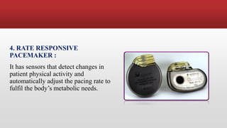 Heart Rate Mschart Pacemaker PACEMAKER | PDF