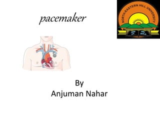 By
Anjuman Nahar
pacemaker
 