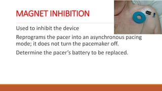 pacemaker.pdf