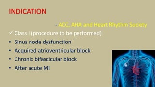 pacemaker.pdf