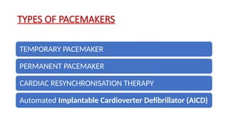 Placemaker Types pacemaker from basics to beyond DM level.pptx