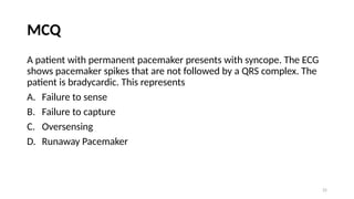 Runawau Pacemaker Pacemaker.pptx.dr.samir.pptxhhhhhhhhhhhhhh | PPTX