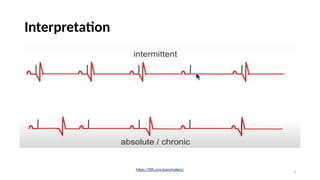 Pacemaker.pptx.dr.samir.pptxhhhhhhhhhhhhhh | PPTX