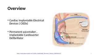 Pacemaker.pptx.dr.samir.pptxhhhhhhhhhhhhhh | PPTX