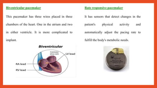 Pacemaker | PPTX