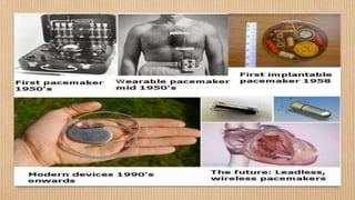Old Design Pacemaker Pacemaker | PPTX