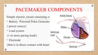 Pacemaker | PPTX