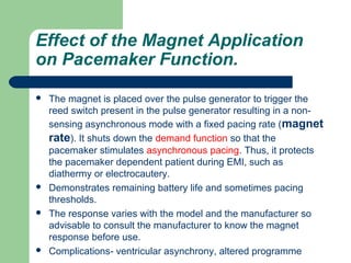 Pacemaker and anaesthetic implications | PPT