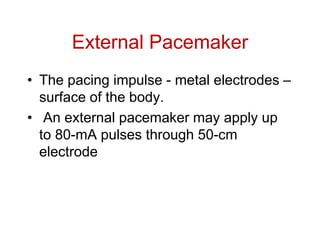 External Pacmker NEED OF PHYSIOLOGICAL AND ELECTROTHERAPY EQUIPMENTS | PPT