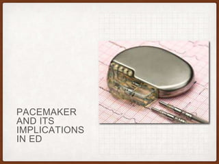 PACEMAKER
AND ITS
IMPLICATIONS
IN ED
 
