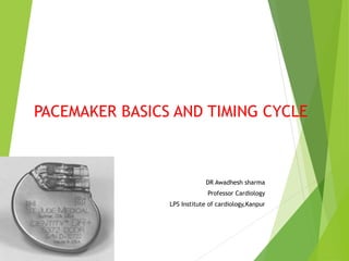 PACEMAKER BASICS AND TIMING CYCLE
DR Awadhesh sharma
Professor Cardiology
LPS Institute of cardiology,Kanpur
 