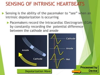 PACEMAKER BASIC AND TIMING CYCLE .pptx