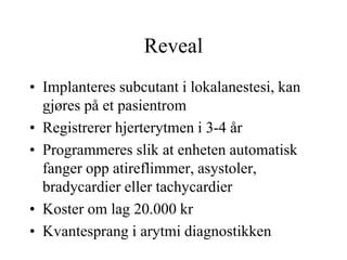 Reveal
• Implanteres subcutant i lokalanestesi, kan
gjøres på et pasientrom
• Registrerer hjerterytmen i 3-4 år
• Programmeres slik at enheten automatisk
fanger opp atireflimmer, asystoler,
bradycardier eller tachycardier
• Koster om lag 20.000 kr
• Kvantesprang i arytmi diagnostikken
 