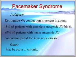 Incidence:
    Retrograde VA conduction is present in about;
- 15% of patients with complete antegrade AV block.
- 67% of patients with intact antegrade AV
-   conduction paced for sinus node disease.
       Onset:
    May be acute to chronic.
 