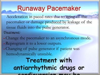 Acceleration in paced rates due to aging of the
  pacemaker or damage produced by leakage of the
  tissue fluids into the pulse generator.
Treatment:
- Change the pacemaker to an asynchronous mode.
- Reprogram it to a lower outputs.
- Changing of pulse generator if patient was
  hemodynamically unstable.
         Treatment with
     antiarrhythmic drugs or
 