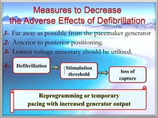 Defibrillation   Stimulation
                                loss of
                  threshold
                               capture
 