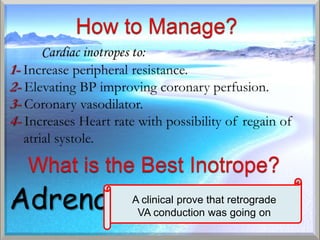 A clinical prove that retrograde
 VA conduction was going on
 