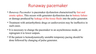 Runawau Pacemaker PACEMAKER CASE DISCUSSION.pptxjjjjjddtdrdzesdsfdtftrtssesrft | PPTX