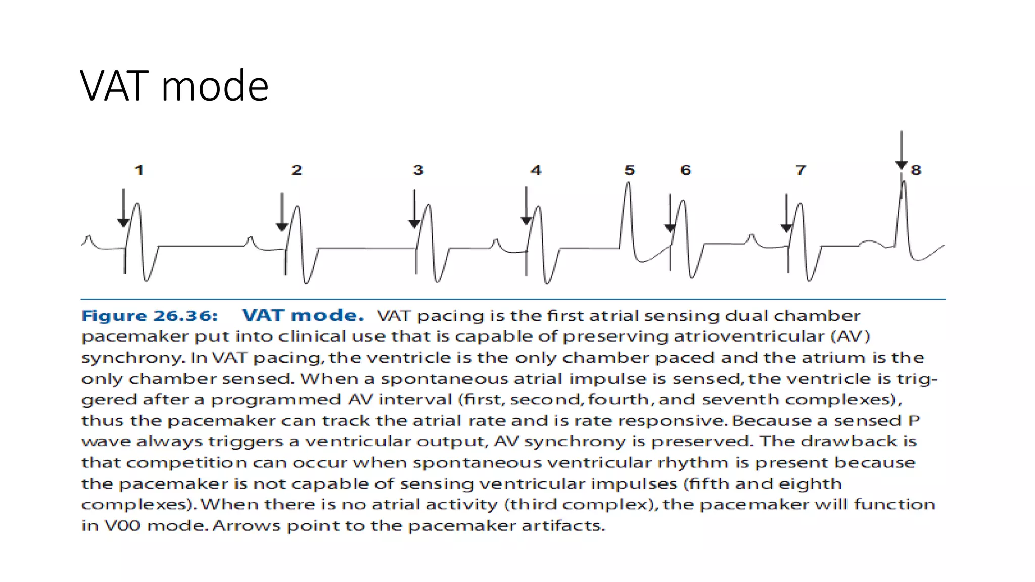 Ecg Post Pacemaker Pacemaker ecg | PPTX