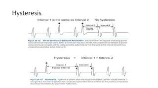 Hysteresis
 