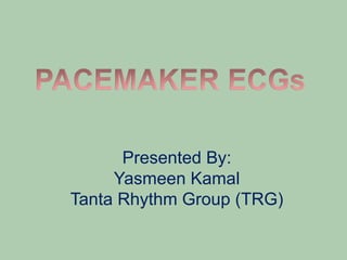 Presented By:
Yasmeen Kamal
Tanta Rhythm Group (TRG)
 