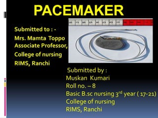 PACEMAKER
Submitted to : -
Mrs. Mamta Toppo
Associate Professor,
College of nursing
RIMS, Ranchi
Submitted by :
Muskan Kumari
Roll no. – 8
Basic B.sc nursing 3rd year ( 17-21)
College of nursing
RIMS, Ranchi
 