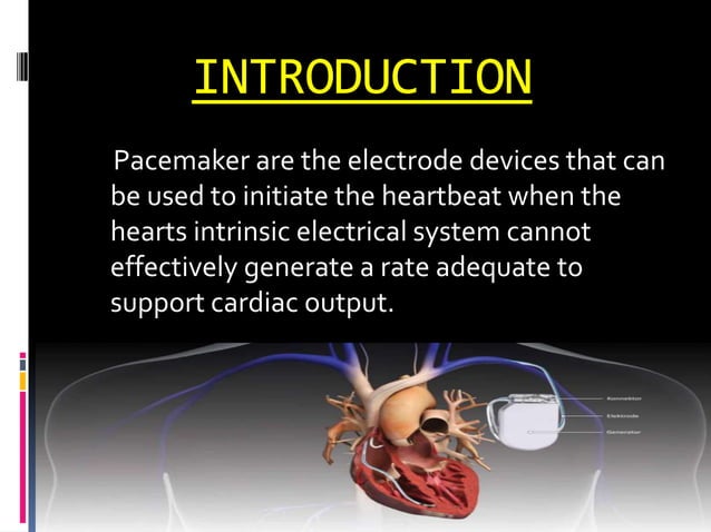 Pacemaker powerpoint presentation med surg | PPTX | Heart and ...