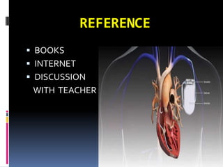 REFERENCE
 BOOKS
 INTERNET
 DISCUSSION
WITH TEACHER
 