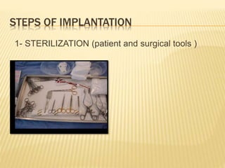 STEPS OF IMPLANTATION
1- STERILIZATION (patient and surgical tools )
 