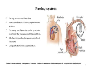 Pacing system
 Pacing system malfunction
 consideration of all the components of
system
 Focusing purely on the pulse generator
overlook the true cause of the problem.
 Malfunctions of pulse generators least
frequent
 Unique behavioral eccentricities.
Cardiac Pacing and ICDs, Ellenbogen, 4th edition, Chapter 7, Evaluation and Management of Pacing System Malfunctions
2
 