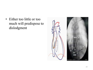 • Either too little or too
much will predispose to
dislodgment
23
 