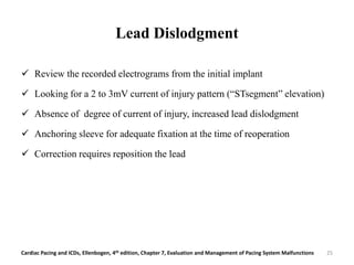 Lead Dislodgment
 Review the recorded electrograms from the initial implant
 Looking for a 2 to 3mV current of injury pattern (“STsegment” elevation)
 Absence of degree of current of injury, increased lead dislodgment
 Anchoring sleeve for adequate fixation at the time of reoperation
 Correction requires reposition the lead
Cardiac Pacing and ICDs, Ellenbogen, 4th edition, Chapter 7, Evaluation and Management of Pacing System Malfunctions 25
 