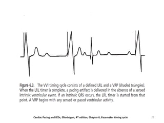 27Cardiac Pacing and ICDs, Ellenbogen, 4th edition, Chapter 6, Pacemaker timing cycle
 