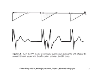 28Cardiac Pacing and ICDs, Ellenbogen, 4th edition, Chapter 6, Pacemaker timing cycle
 