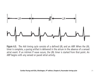 29Cardiac Pacing and ICDs, Ellenbogen, 4th edition, Chapter 6, Pacemaker timing cycle
 