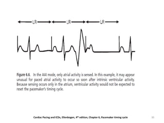 30Cardiac Pacing and ICDs, Ellenbogen, 4th edition, Chapter 6, Pacemaker timing cycle
 