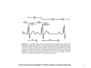 31Cardiac Pacing and ICDs, Ellenbogen, 4th edition, Chapter 6, Pacemaker timing cycle
 