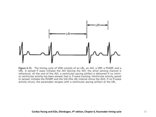 33Cardiac Pacing and ICDs, Ellenbogen, 4th edition, Chapter 6, Pacemaker timing cycle
 