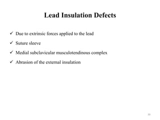 Lead Insulation Defects
 Due to extrinsic forces applied to the lead
 Suture sleeve
 Medial subclavicular musculotendinous complex
 Abrasion of the external insulation
39
 