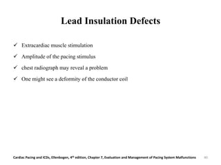 Lead Insulation Defects
 Extracardiac muscle stimulation
 Amplitude of the pacing stimulus
 chest radiograph may reveal a problem
 One might see a deformity of the conductor coil
Cardiac Pacing and ICDs, Ellenbogen, 4th edition, Chapter 7, Evaluation and Management of Pacing System Malfunctions 40
 