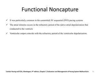 Functional Noncapture
 It was particularly common in the committed AV sequential (DVI) pacing systems
 The atrial stimulus occurs in the refractory period of the native atrial depolarization that
conducted to the ventricle
 Ventricular output coincide with the refractory period of the ventricular depolarization.
Cardiac Pacing and ICDs, Ellenbogen, 4th edition, Chapter 7, Evaluation and Management of Pacing System Malfunctions 45
 